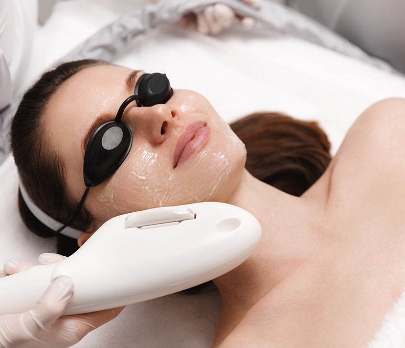 ipl-procedure