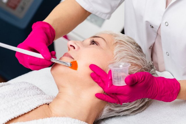 Chemical Peel Treatment in Vancouver, WA Chemical Peel Treatment in Vancouver, WA